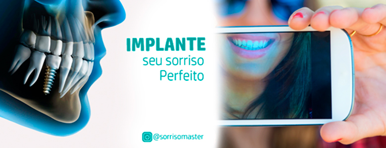 implante-capa